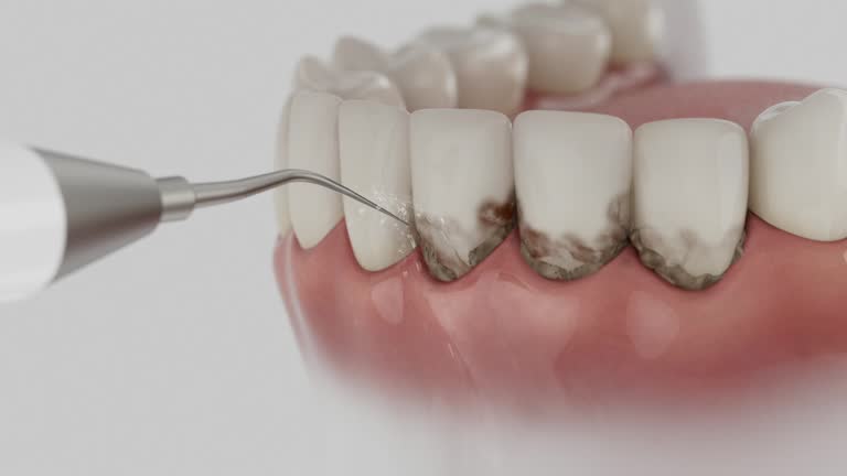 Trusted Invisalign Clear Aligners service in Lakemoor, IL - Dentist Open Now